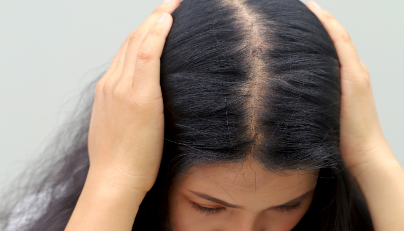 Hair Loss in London: When Should You Consider PRP Hair Treatment?